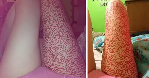 Girl Shares Therapist's Advice To Draw On Her Body Instead O