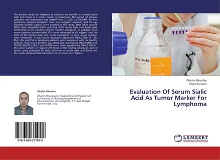 Evaluation Of Serum Sialic Acid As Tumor Marker For Lymphoma.. Dhafer Alkoofee a