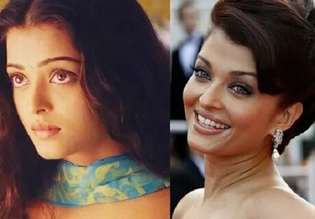 11 Bollywood Actress Who Have Allegedly Undergone Plastic Su