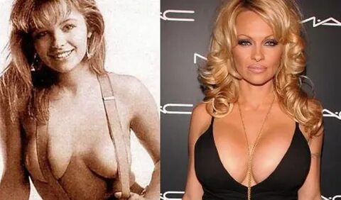 Celebrity Surgery Before and After: Most Shocking Celebrity 