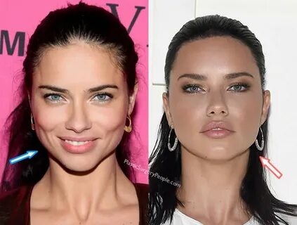 Did Adriana Lima Have Plastic Surgery? (Before & After 2020)