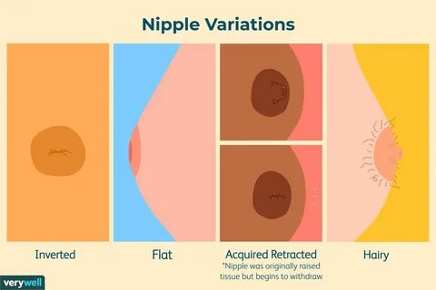 4 Nipple Types: Protruding, Flat, Inverted, Unclassified.