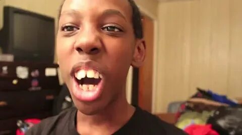 His Teeth Though: The Most Messed Up Teeth Ever! Video