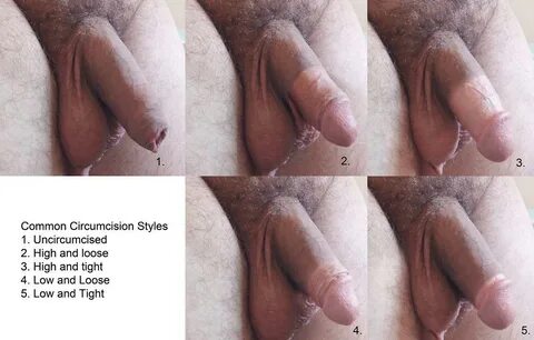 Uncircumcised penis images