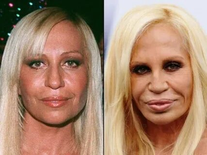 Pin by Dawn Dalyce on Celebrities-Before & After Donatella v