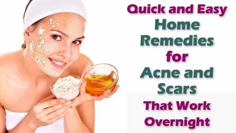 Acne Home Remedy - Fast And Best Natural Methods To Get Rid 