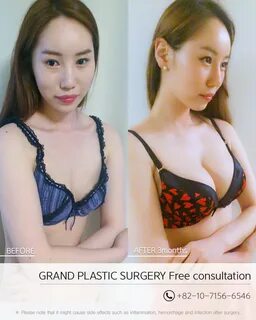 Plastic surgery app free boobs
