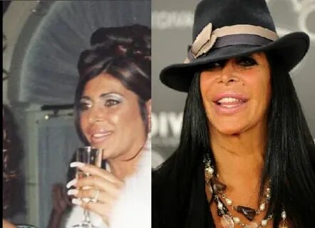 Big Ang Plastic Surgery is a Nightmare