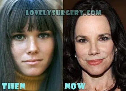 Barbara Hershey Plastic Surgery Before and After Photo - Lov