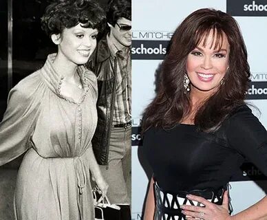 The reality behind the Marie Osmond Boob Job - Plastic Surge