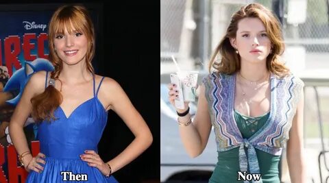 Bella Thorne Plastic Surgery Before and After Photos