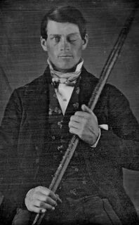 VintagePhotos on Twitter Phineas gage, Medical miracles, Mys