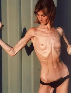 Anorexia is beautiful MOTHERLESS.COM ™