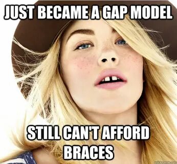 Just became a gap model Still can't afford braces - Gap Mode