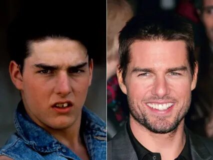 Tom Cruise Teeth Before : Tom Cruise has one big tooth place