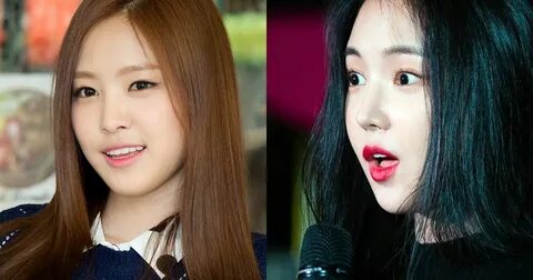 Selalu Bungkam Terkait Tudingan Operasi Plastik, Naeun APink