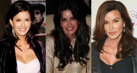 Janice Dickinson Plastic Surgery Before and After Pictures 2