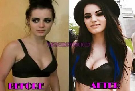 Paige WWE Plastic Surgery Before and After Photos Plastic su