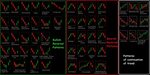 Candlestick strategy trading Forex