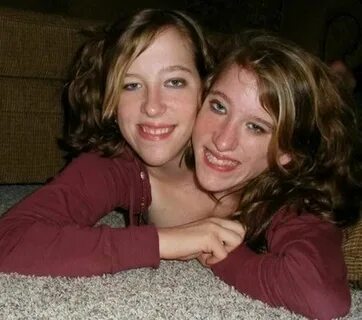 Conjoined Twins Abby And Brittany Married - The Sex Lives Of