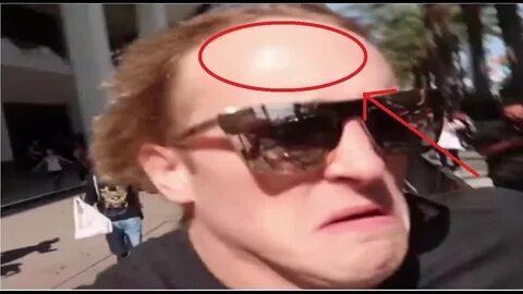 LOGAN PAUL IS BALDING?! - YouTube