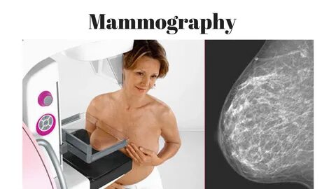 Boobs hurt after mammogram