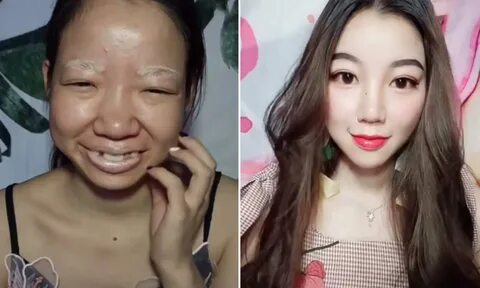 Asian girl tapes her face to look smaller