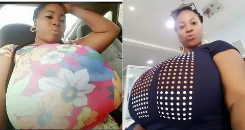 This Nigerian Lady's Gigantic WaterMelon Causes Earthquake O