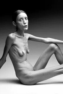 Голые девушки с анорексией - 71 красивых секс фото