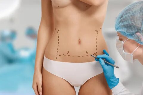 Liposuction (Liposakşın) nedir? - Fiyatları 2022