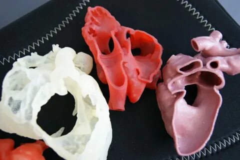 King's College London в Твиттере: "3D-printed hearts and kid