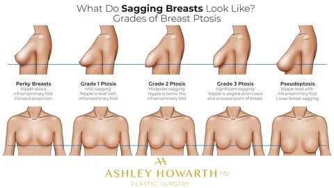 How to avoid saggy boobs