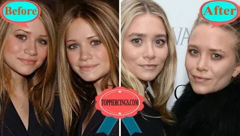 Mary-Kate Olsen Plastic Surgery Why Do Mary Kate and Ashley 