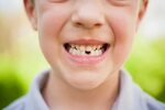 The Tooth Fairy and Losing a First Baby Tooth