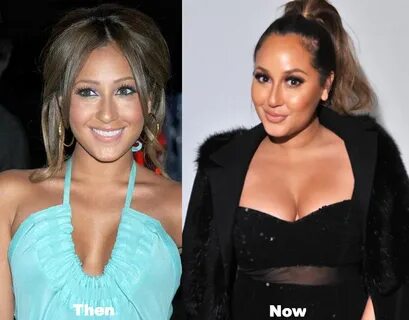 Adrienne Bailon Plastic Surgery Before and After Photos