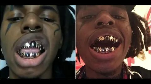 Zillakami Grillz posted by Christopher Simpson