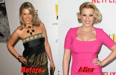 Jodie sweetin breast 🌈 Jodie Sweetin Plastic Surgery Before 