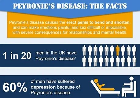 Peyronie's disease: The condition that affects millions of m