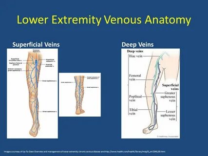 Arterial and Venous Disease - ppt download
