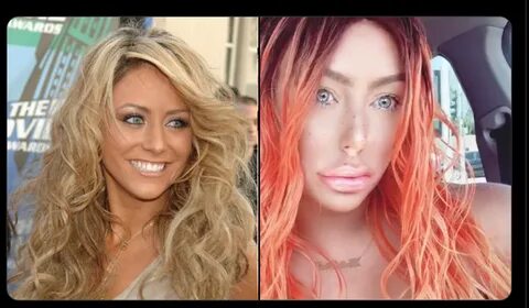 Aubrey O'day Plastic Surgery Before And After - Aubrey O Day