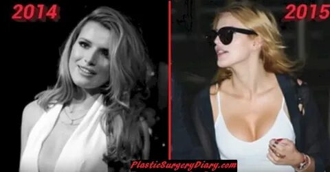 Bella Thorne Plastic Surgery After and Before - Nose and Bre