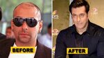 10 Bollywood Stars That Underwent The Hair Transplant Surger