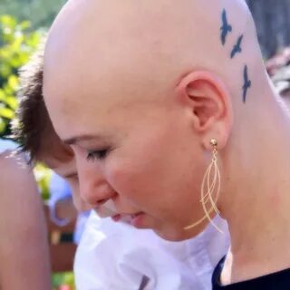 Women With Alopecia Areata Support Network Blog Thea Chassin