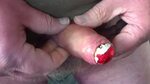 Foreskin with Chocolate Candy, Gay Amateur Porn 15: xHamster