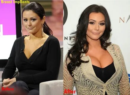 Jwoww Before And After Plastic Surgery : 'Jersey Shore' Cast