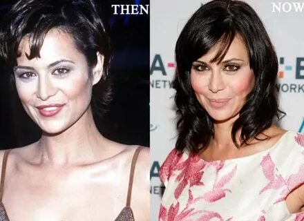 Catherine Bell Plastic Surgery Photo Before and After - CELE