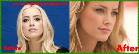 Amber Heard Plastic Surgery Nose Job Dr Before And after Sur
