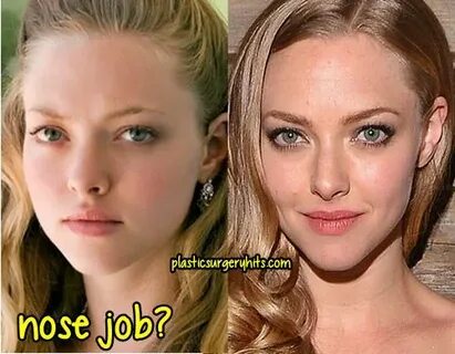 Amanda Seyfried Plastic Surgery Fact or Rumor - Plastic Surg