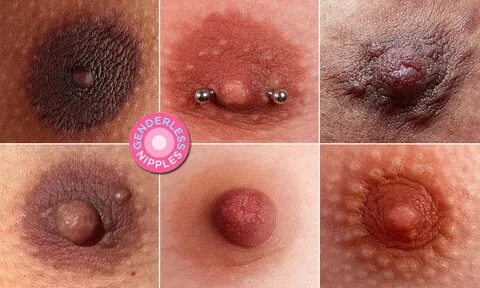 Discolorification above nipple on right boob