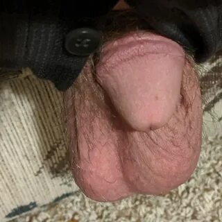 Micro penis " Top of all time Sharesome